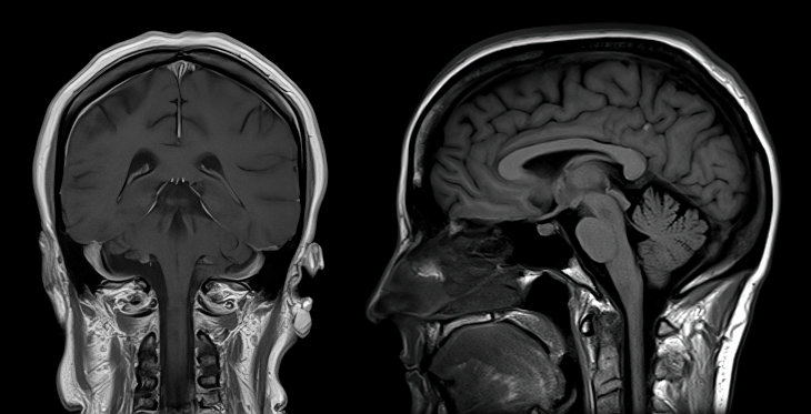 Science Enters the Mysterious Inner World of Consciousness